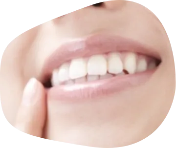 ●