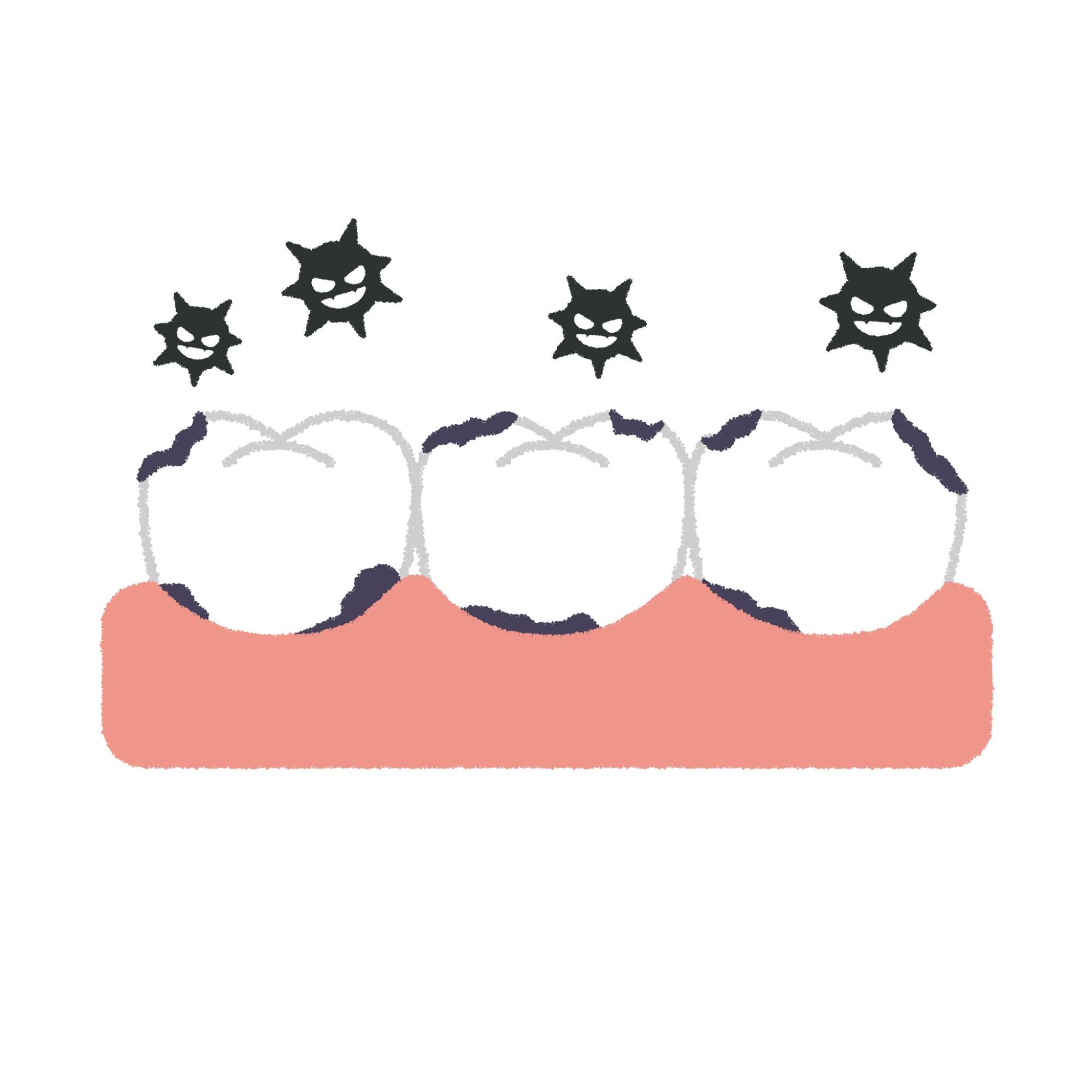虫歯菌と虫歯だらけの歯のイラスト