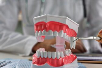 歯周病による抜歯を模型で説明している医師