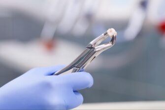 抜歯した歯を抜歯鉗子で挟んでいる様子